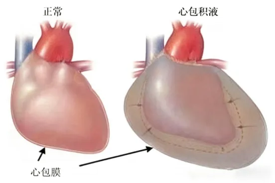 17591976225729412304.png@!webp